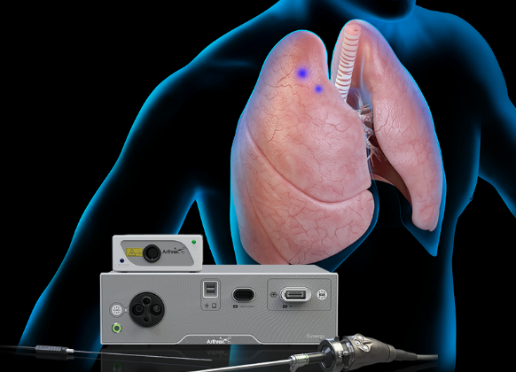 Arthrex - Cardiothoracic Surgery